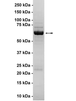 Eurofins DiscoverX ALK4 Protein, Active 250 &mu;g | Buy Online | Eurofins DiscoverX | Fisher Scientific